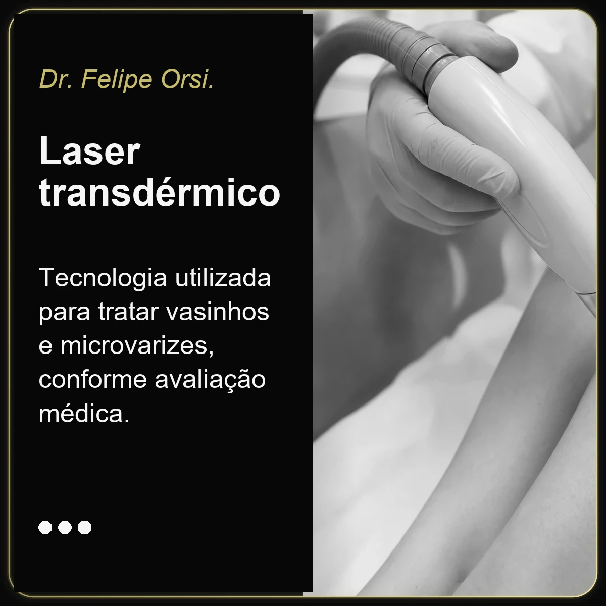 Dr. Felipe Orsi — laser transdérmico para vasinhos e microvarizes