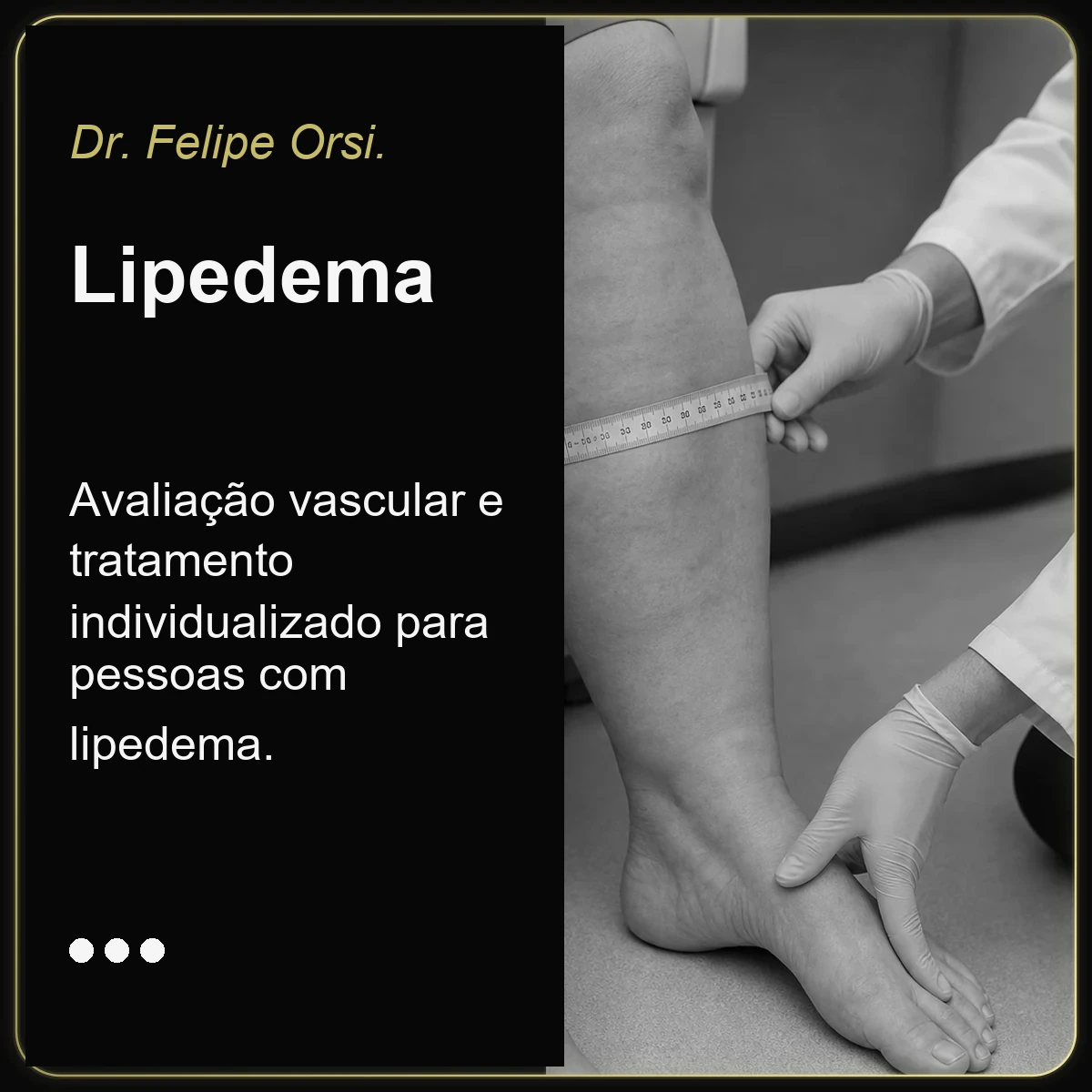 Dr. Felipe Orsi — tratamento de lipedema