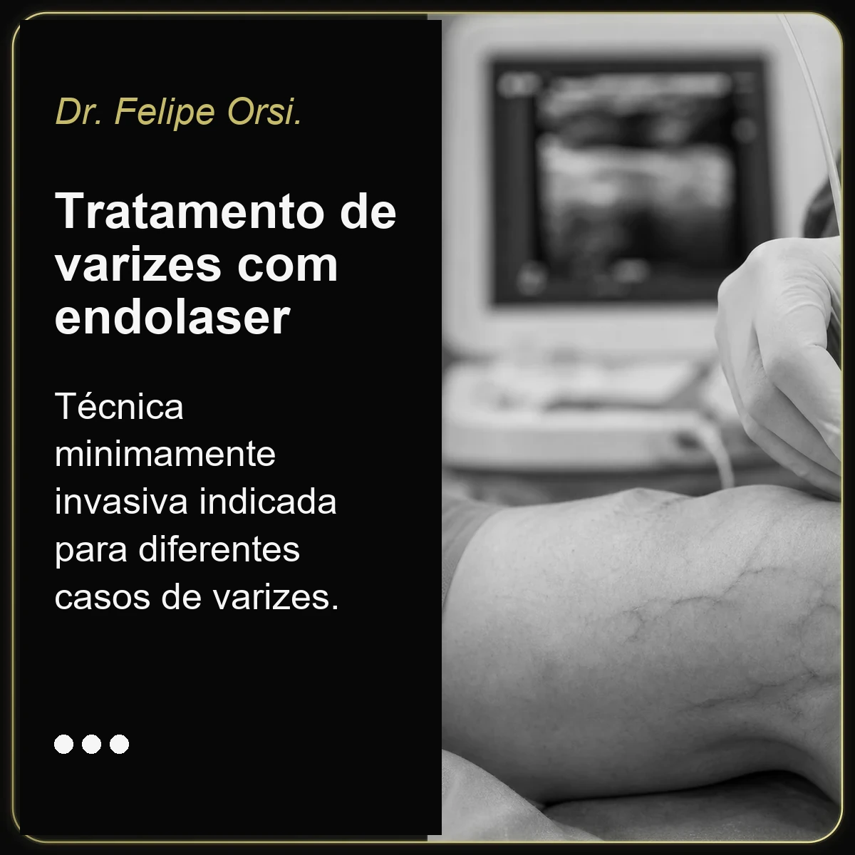 Dr. Felipe Orsi — tratamento de varizes com endolaser